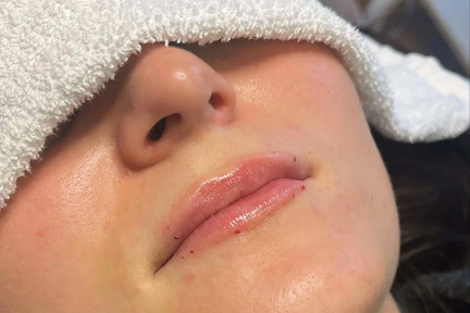 Resultat etter nydelig hudpleie utdanning av student i Tønsberg