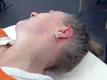 Oereakupunktur-cover