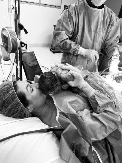 mother assisted cesarean birth