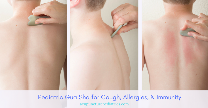 Pediatric Gua Sha for Cough, Allergies, & Immunity