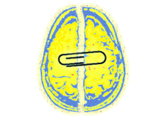 brain-widget-icon