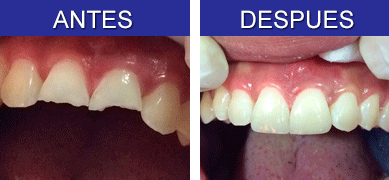 diseno-sonrisa-colombia