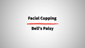 10. Bell's Palsy_1