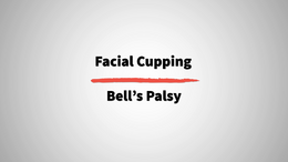 10. Bell's Palsy_1