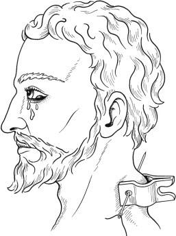 Seton