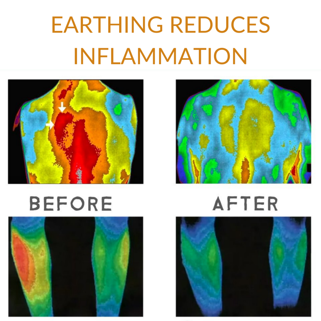 EARTHING REDUCES INFLAMMATION