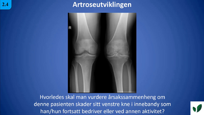 JK11 Artroseutviklingen 2.4