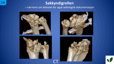 JK11 Sakkyndigrollen 2.6