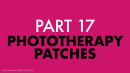 Headache and Migraine Part 17 Phototherapy Patches