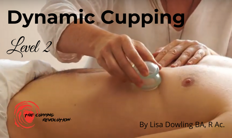 Dynamic Cupping ONLINE