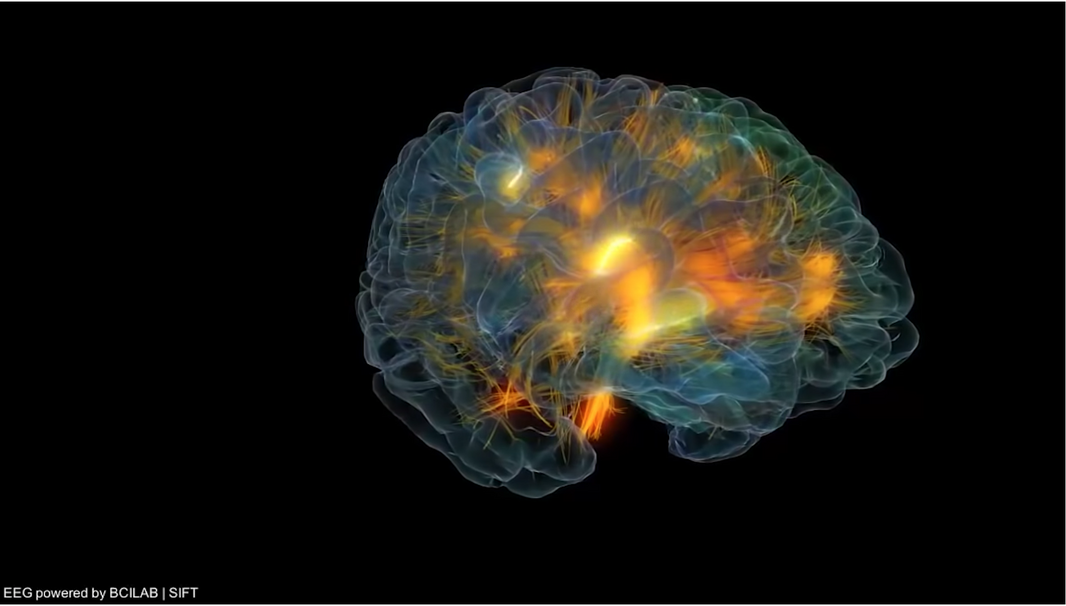 brain activity