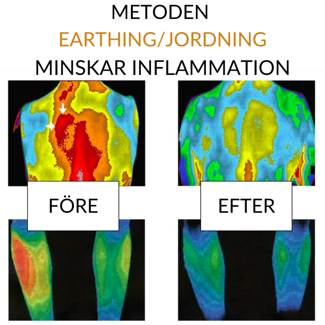 metoden_jordning_minskar_inflammation