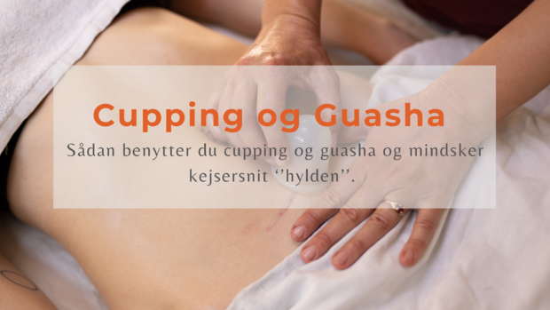 Cupping og Guasha