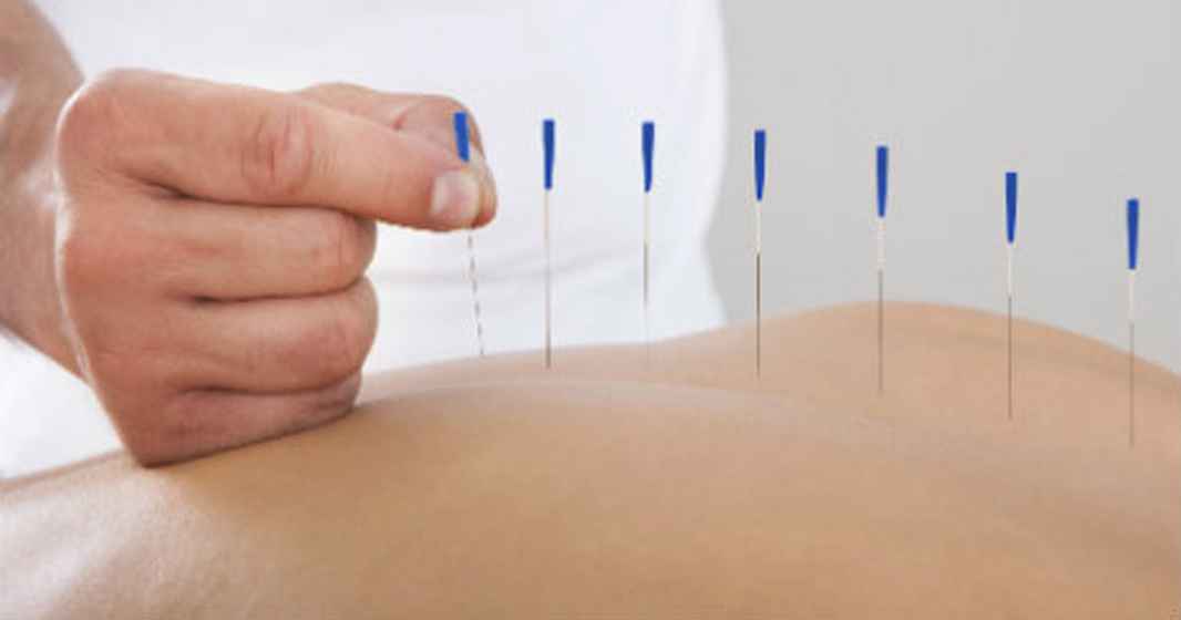Akupunktur.karenbro.dk_.3
